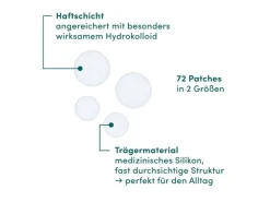 Apricot Pickel Patches 72 Stück