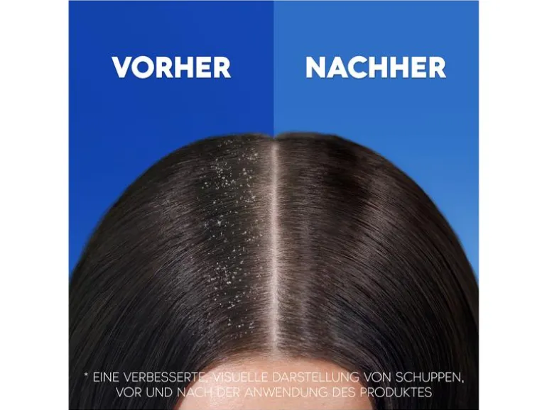 head and shoulders Shampoo Anti-Schuppen classic clean 500 ml