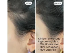VEDIC Lab Kopfhaut-Elixier 100 ml